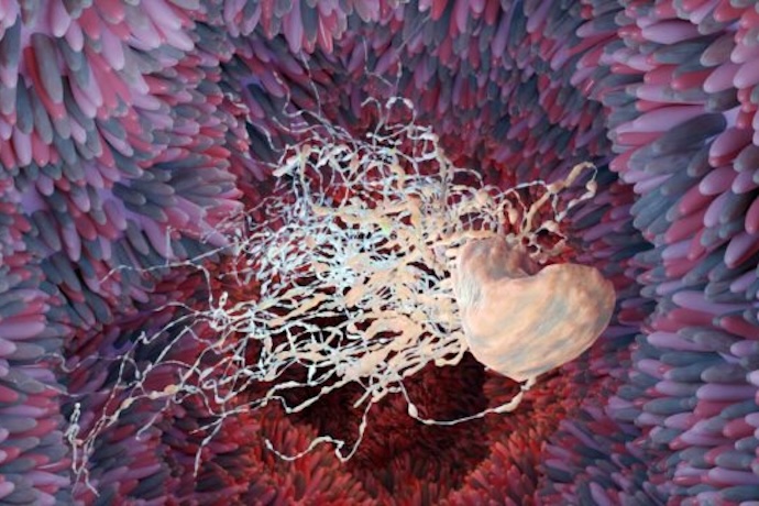 An image of H. pylori attached to stomach lining