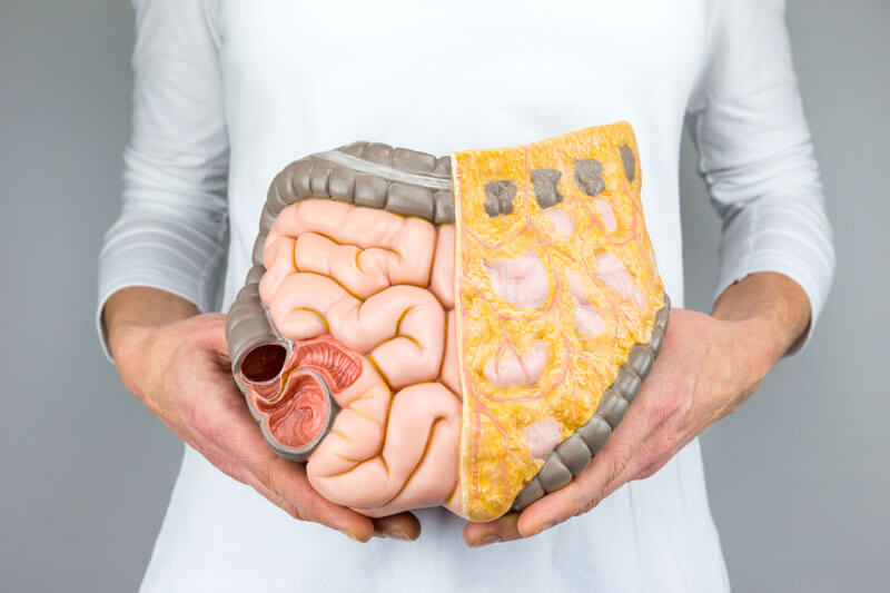 Colon cancer prevention